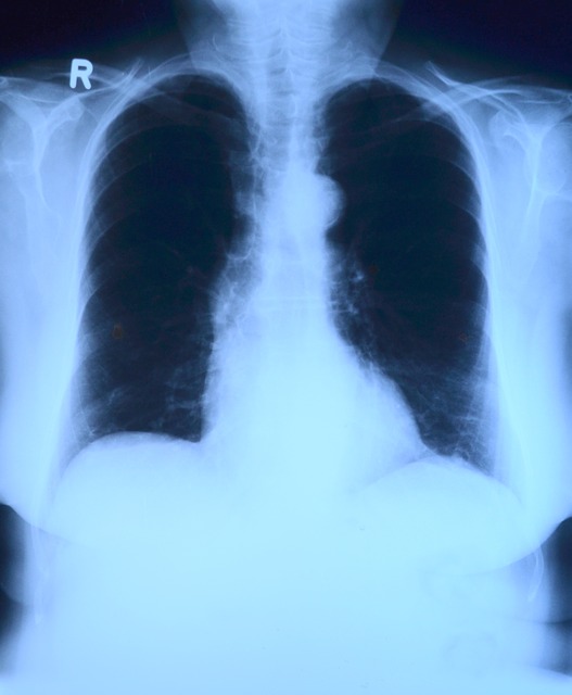 VNAs are becoming a favoured method for medical image sharing, survey reveals
